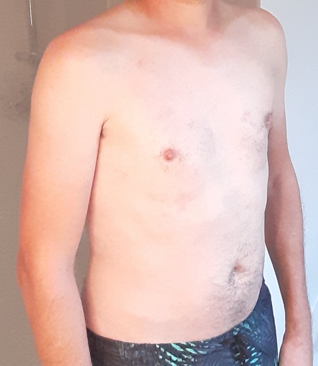 Profil de Joevin, 42 ans, Escort TS France à Oursel-Maison